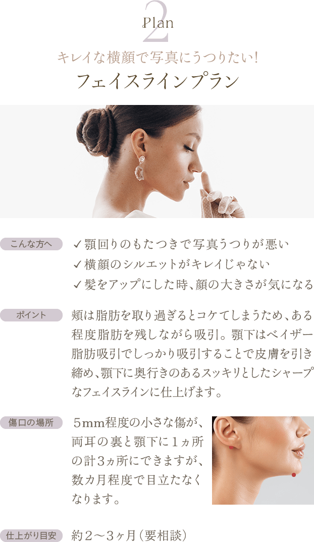 Plan2 キレイな横顔で写真にうつりたい! フェイスラインプラン | こんな方へ: ✓ 顎回りのもたつきで写真うつりが悪い／✓ 横顔のシルエットがキレイじゃない／✓ 髪をアップにした時、顔の大きさが気になる / ポイント: 頬は脂肪を取り過ぎるとコケてしまうため、ある程度脂肪を残しながら吸引。 顎下はベイザー脂肪吸引でしっかり吸引することで皮膚を引き締め、顎下に奥行きのあるスッキリとしたシャープなフェイスラインに仕上げます。 / 傷口の場所: ５mm程度の小さな傷が、両耳の裏と顎下に１ヵ所の計３ヵ所にできますが、数カ月程度で目立たなくなります。 / 仕上がり目安: 約２〜３ヶ月（要相談）