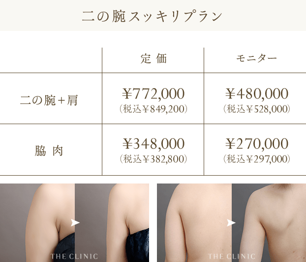 二の腕スッキリプラン | 二の腕＋肩: 定価 ¥772,000（税込￥849,200） / モニター: ¥480,000（税込￥528,000） | 脇肉: 定 価 ¥348,000（税込￥382,800） / モニター: ¥270,000（税込￥297,000）