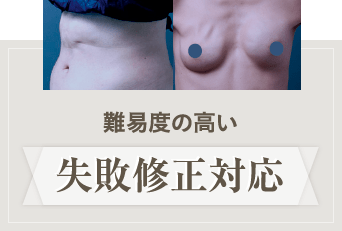 難易度の高い失敗修正対応
