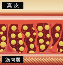 セルライトの除去 The Clinic ザクリニック 公式