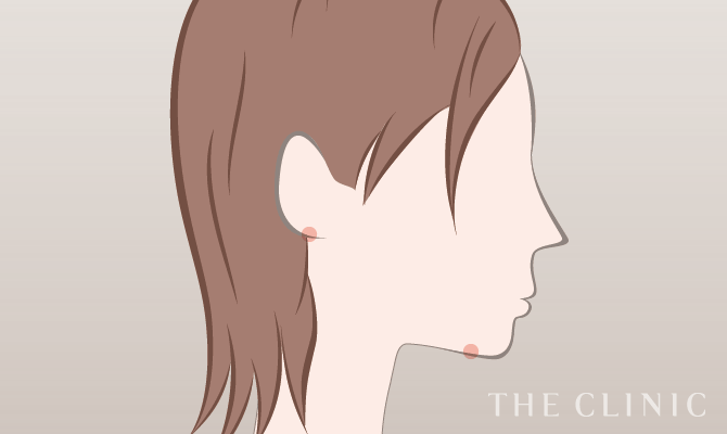 顔 ホホ アゴ の脂肪吸引 The Clinic ザクリニック 公式