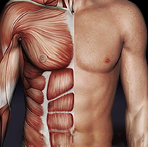 ベイザー4D(男性のシックスパック脂肪吸引)