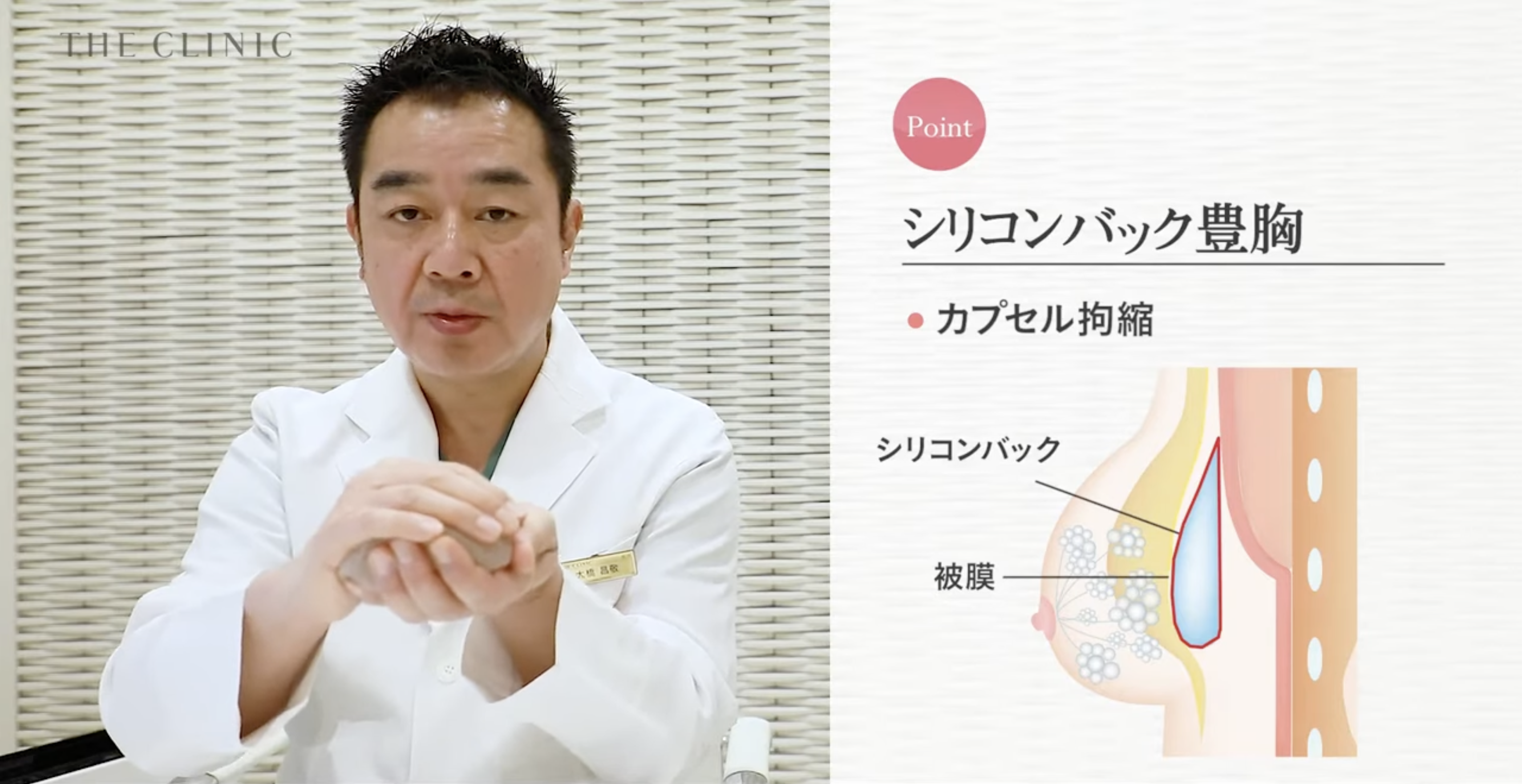 シリコンバッグ豊胸のカプセル拘縮
