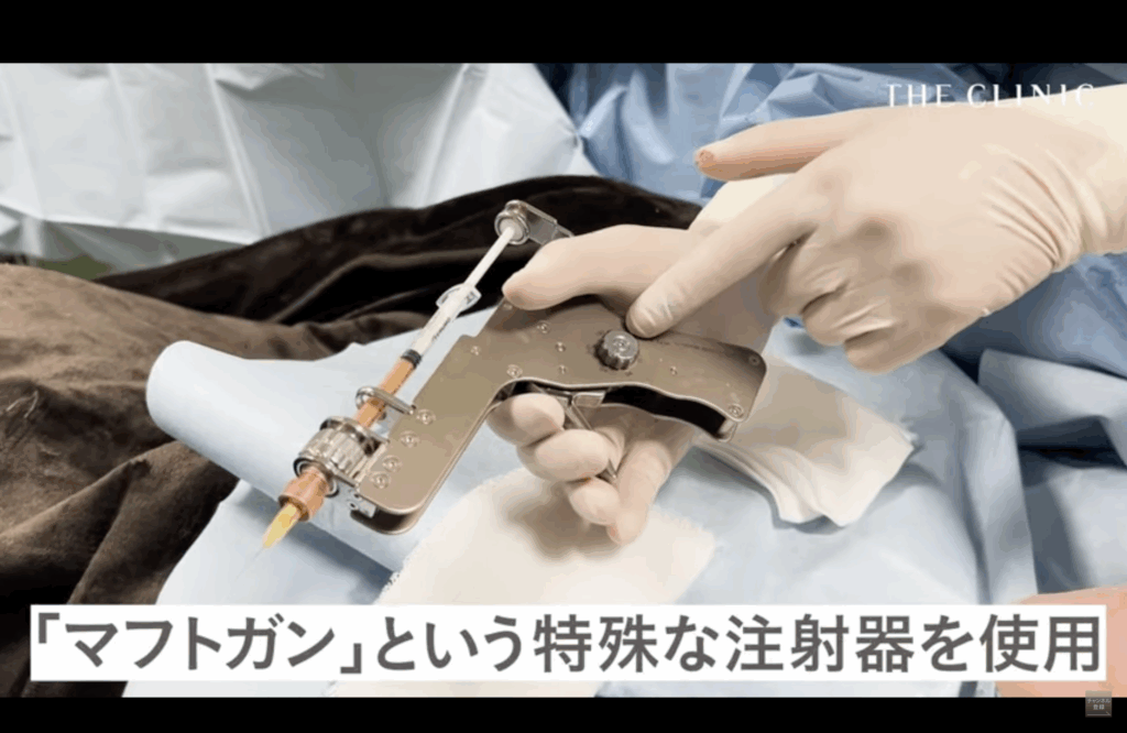 脂肪の微量注入専用の医療機器「マフトガン」