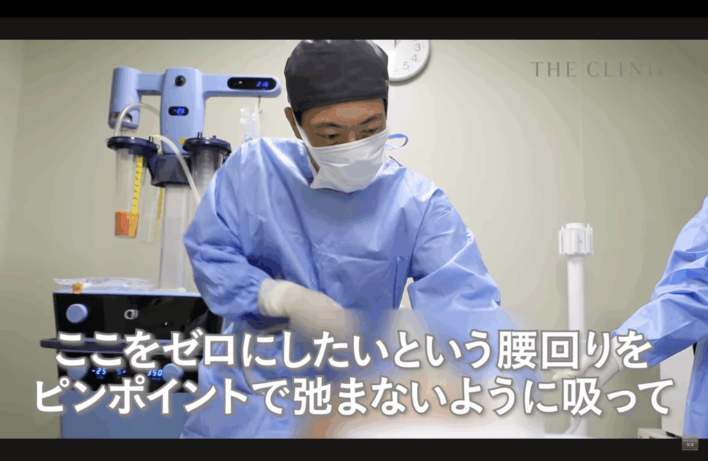 腰の脂肪吸引を行う志田ドクター