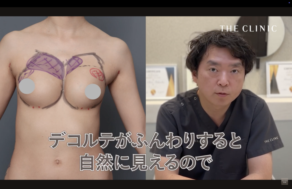 豊胸失敗修正のポイント解説