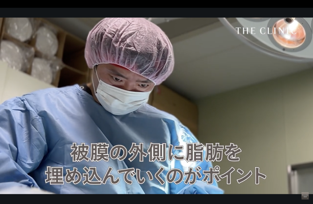 豊胸失敗修正のポイント解説