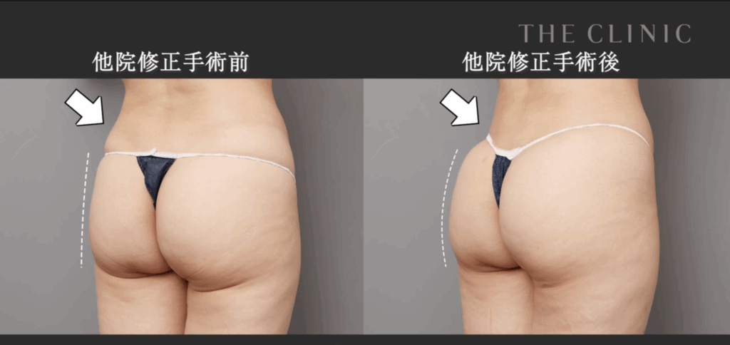 他院修正手術の症例写真