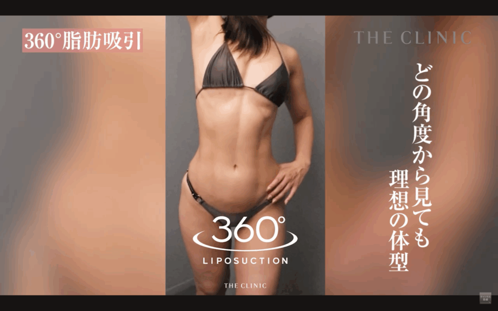 どの角度から見ても理想の体型を実現する360°脂肪吸引