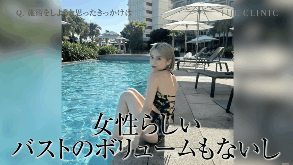 脂肪豊胸を決意するきっかけの写真