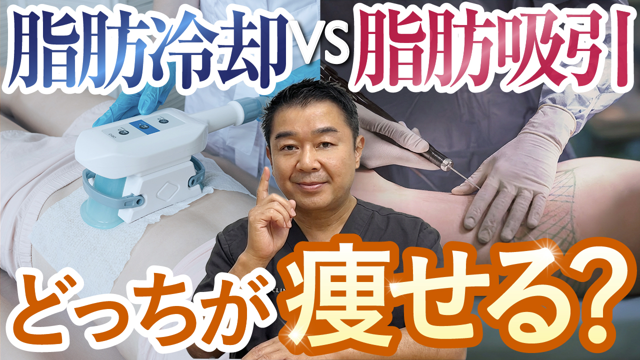 脂肪冷却の効果はある？ない？脂肪吸引との違いを医師が徹底解説｜THE 