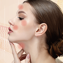 最新のたるみ治療「モフィウス8バースト」を導入しました！