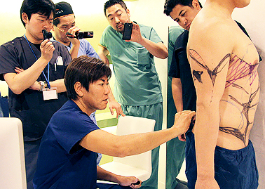 VASER® 4D Sculpt™(ベイザー4D彫刻)トレーニングセミナー開催!