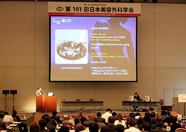 コンデンスリッチ豊胸について日本美容外科学会でランチョンセミナーを行いました