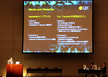 シリコン抜去と同時のコンデンスリッチ豊胸について日本美容外科学会で発表を行いました