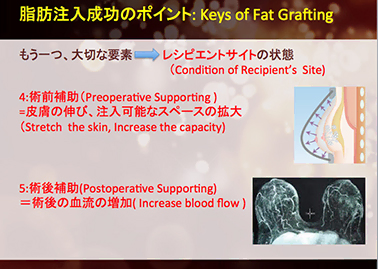 BRAVAとコンデンスリッチ豊胸の併用効果について、ドクター大橋が日本美容外科学会で発表