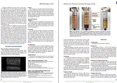 米国形成外科雑誌『PRS-GO』2016年4月号に論文が掲載されました