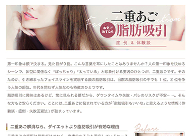 二重あごを解消したい方必見の脂肪吸引コラムを公開しました。