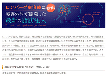 ロンバーグ病に効果的な最新治療のコラムを公開しました。