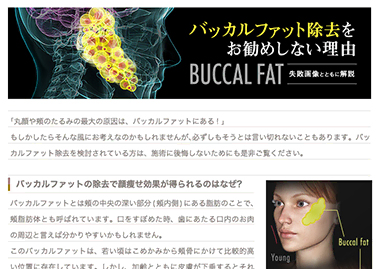 バッカルファット除去についてのコラムを公開しました。