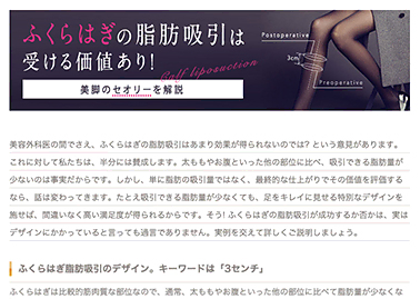 ふくらはぎの脂肪吸引についてのコラムを公開しました。