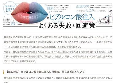 唇のヒアルロン酸注入についてのコラムを公開しました。