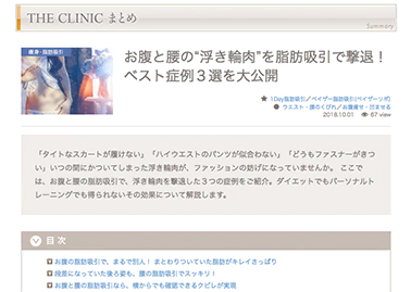 お腹と腰の脂肪吸引についてのまとめ記事を公開しました。