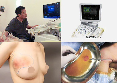 アクアフィリングなどのジェル状充填剤による豊胸術の失敗から女性を救う、専用窓口を開設しました。