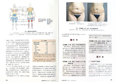 形成外科雑誌『形成外科』に、大橋統括指導医の論文が掲載されました。