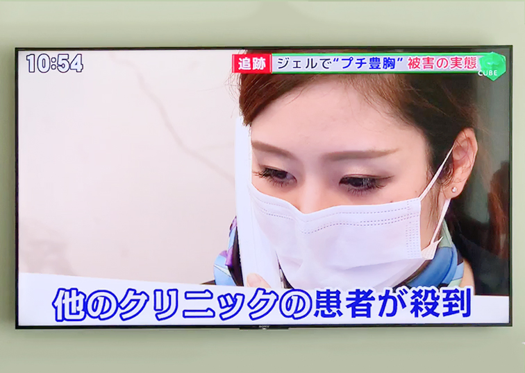 【志田院長 TV出演】ジェル状充填材の危険性が取り上げられました