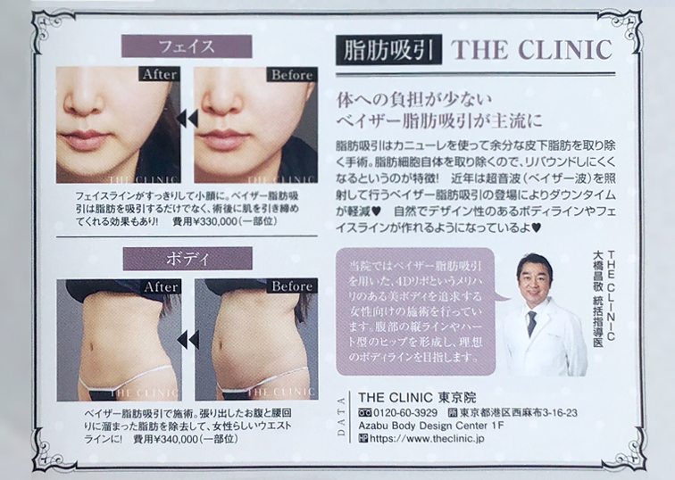 雑誌 『姉ageha 2021年3月号』に、当院の脂肪吸引が紹介されました。