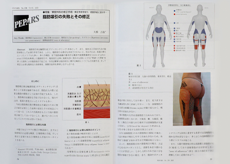 形成外科専門紙『PEPERS』に、大橋統括指導医らの論文が掲載されました