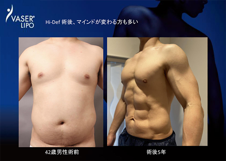 第45回 日本美容外科学会総会(JSAPS)で 大橋 昌敬 統括指導医が発表を行いました