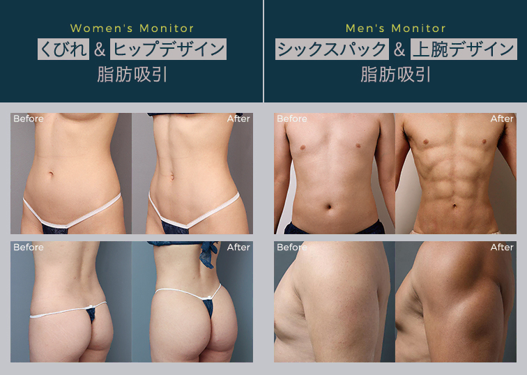 2024年5月28日(火)・29日(水)のDr. Hoyosセミナー開催に伴い、モニターを募集します!